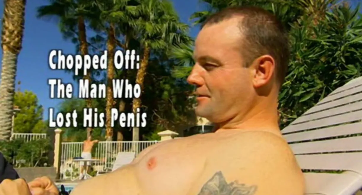 Chopped Off: The Man Who Lost His Penis