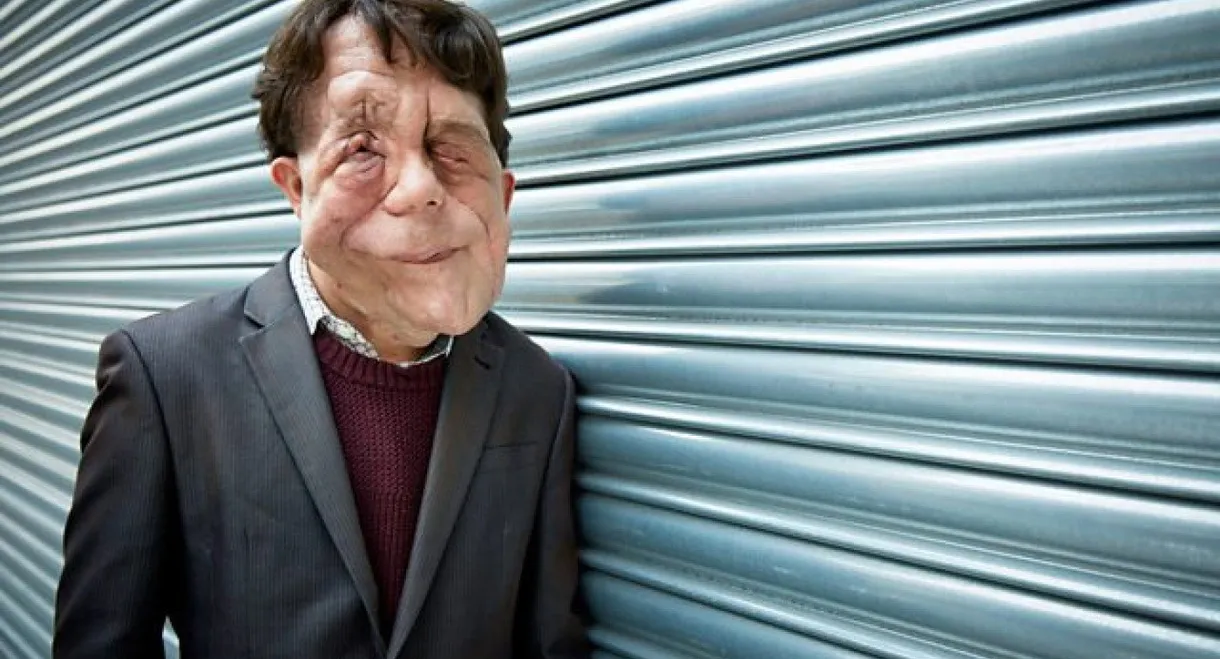 The Ugly Face of Disability Hate Crime