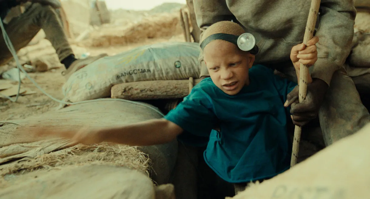 The Boy with White Skin