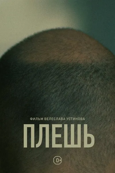 Baldness