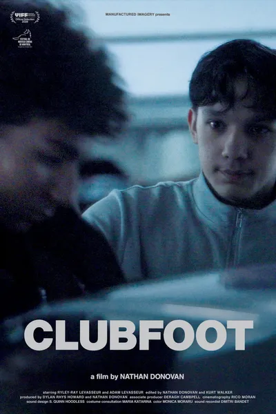 Clubfoot
