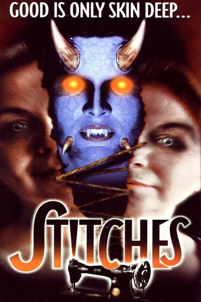 Stitches