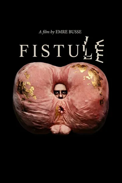 FISTULE