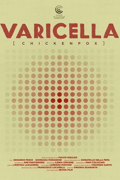 Varicella