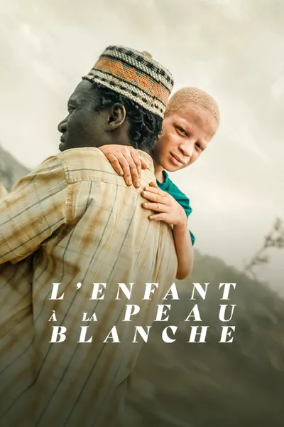 The Boy with White Skin