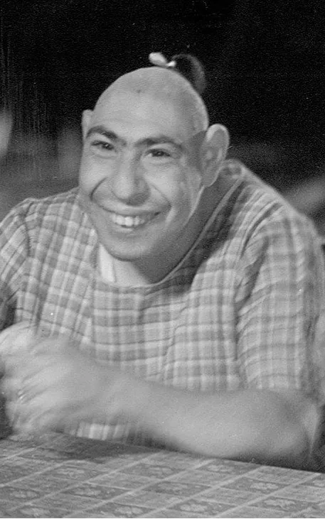 Schlitzie