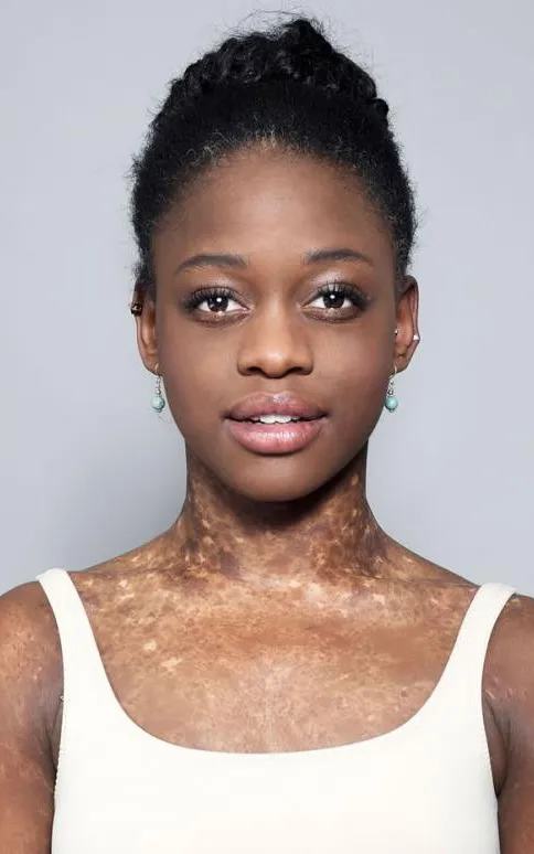 Michaela DePrince