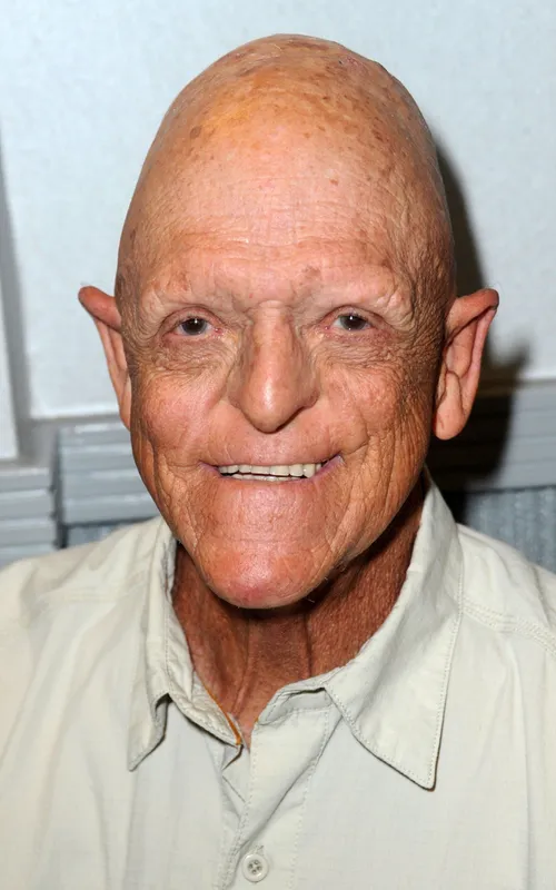 Michael Berryman